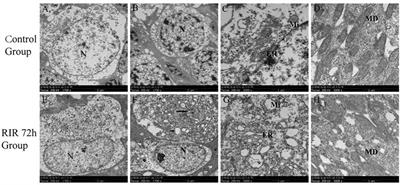 Pathological Changes and Expression of JAK-STAT Signaling Pathway Hallmark Proteins in Rat Retinas at Different Time Points After Retinal Ischemia Reperfusion Injury